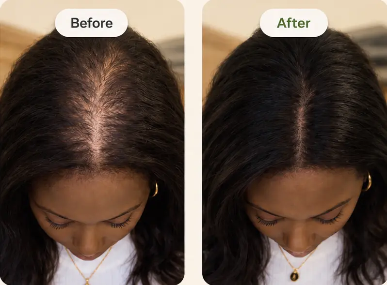 Before and After Results